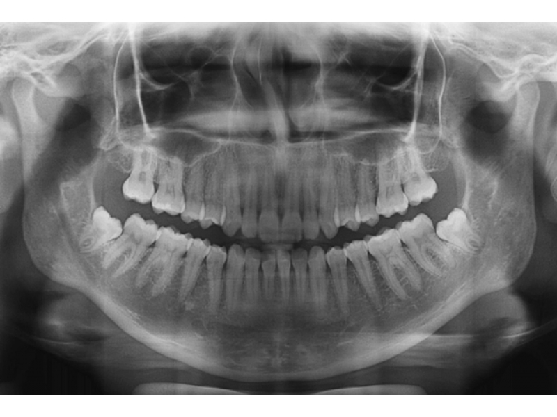 RADIOLOGIA ODONTOLOGICA EM ARAGUAINA -  RADIO CLIN