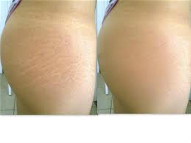 TRATAMENTO DE ESTETICA EM BELFORD ROXO