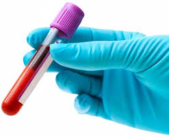 EXAMES DE SANGUE EM PETROPOLIS