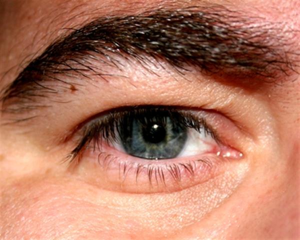 EXAMES DE OLHOS EM DUQUE DE CAXIAS
