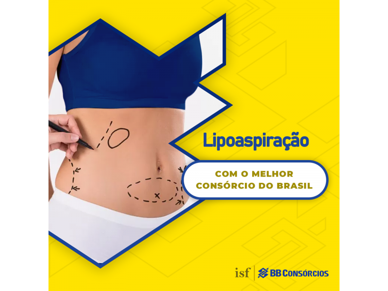 CONSÓRCIO DE CIRURGIA PLÁSTICA EM CARIACICA - ES 