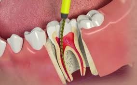 CONSULTÓRIO DENTÁRIO EM ANCHIETA RJ - 21 2451-6380 
