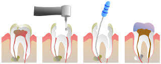 CONSULTÓRIO DENTÁRIO EM ANCHIETA RJ - 21 2451-6380 