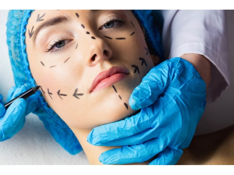 APLICAÇÃO DE BOTOX FACIAL NA BARRA DA TIJUCA NO RIO DE JANEIRO - RJ 