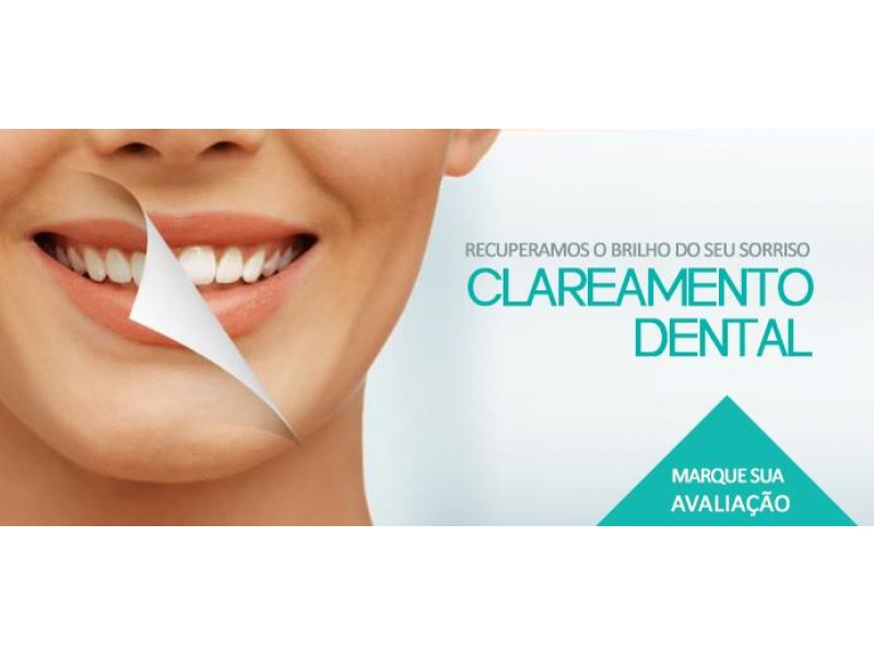 CIRURGIÃO DENTISTA EM SANTA CRUZ DA SERRA DUQUE DE CAXIAS - RJ