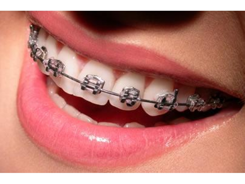 CIRURGIÃO DENTISTA EM SANTA CRUZ DA SERRA DUQUE DE CAXIAS - RJ