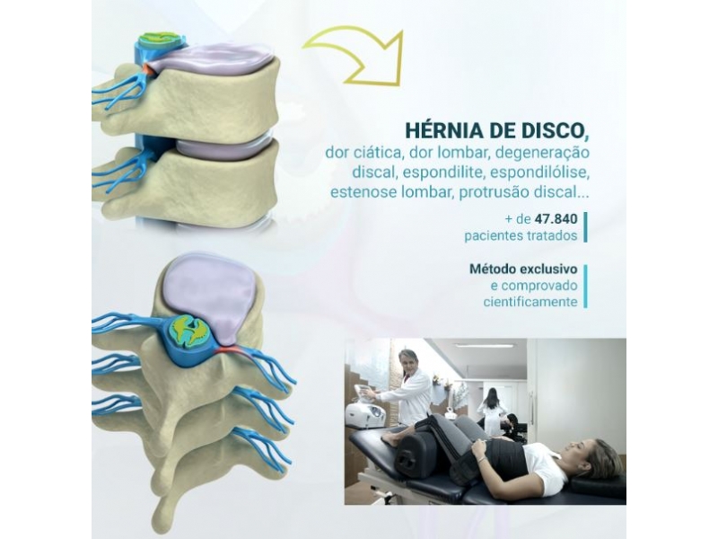 Osteopatia em Porto Velho - Osteo&Fit - Saúde Integral