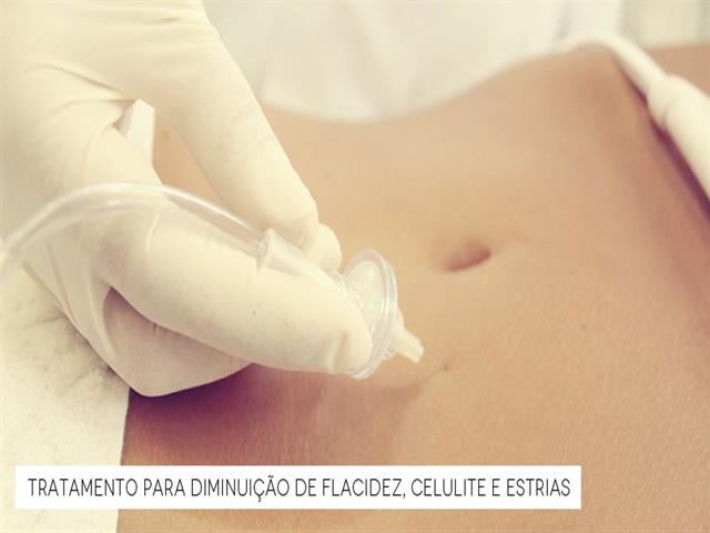 TRATAMENTO DE ESTRIAS E CELULITES EM PORTO ALEGRE - ESPACO AVIVA RS