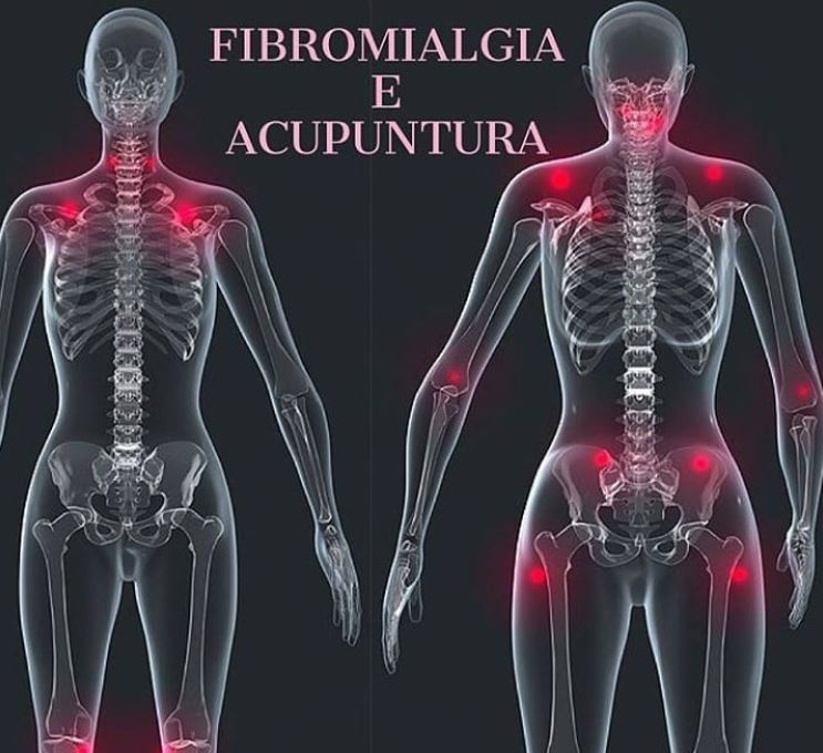 ACUPUNTURA E PILATES NO IBIRAPUERA - SP