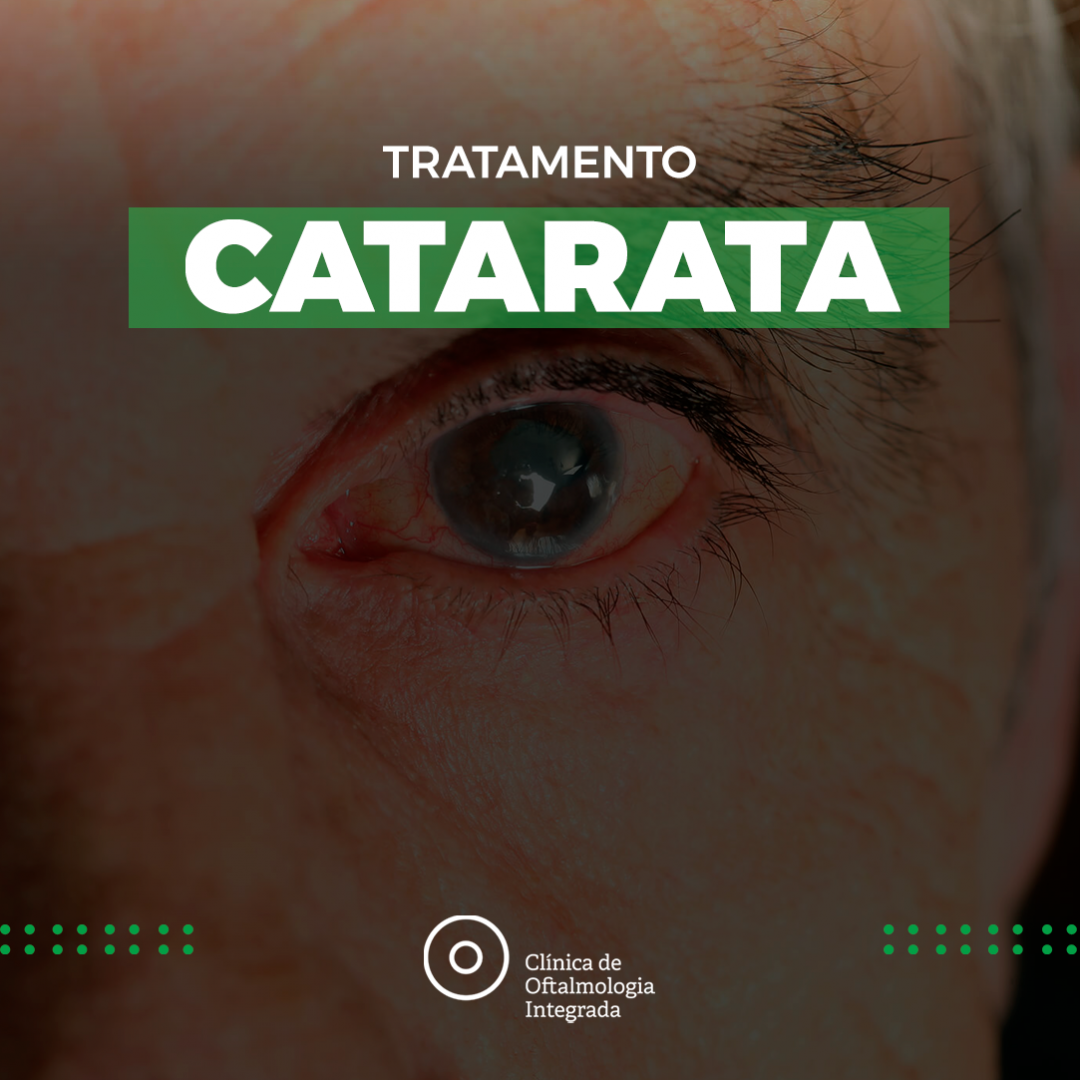 CLÍNICA DE OLHOS AVANÇADA EM CAMPO GRANDE - RJ