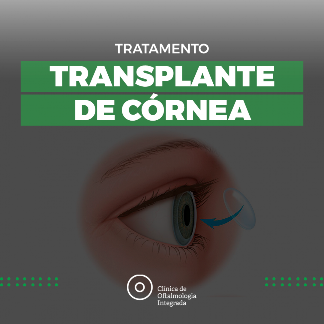 CLÍNICA DE OLHOS AVANÇADA EM CAMPO GRANDE - RJ