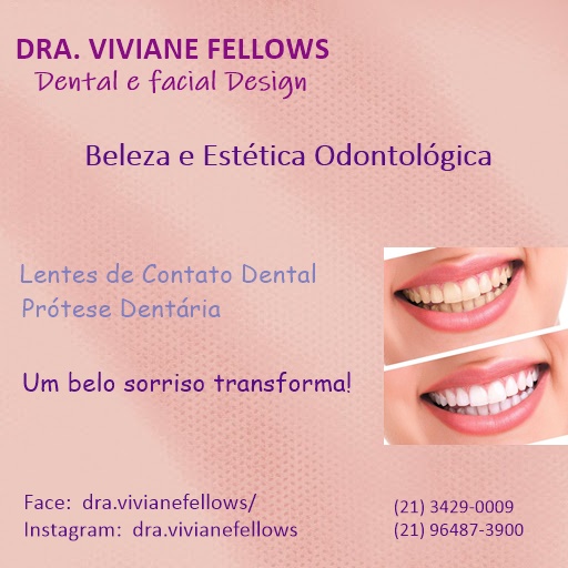 LENTES DE CONTATO DENTAL NA BARRA DA TIJUCA RJ