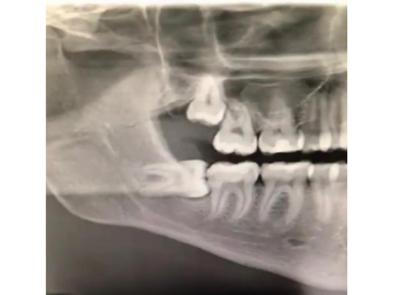 Dr. EVANDRO PAIVA - DENTISTA URGÊNCIA E EMERGÊNCIA 24 HORAS EM ITAPEMIRIM ES