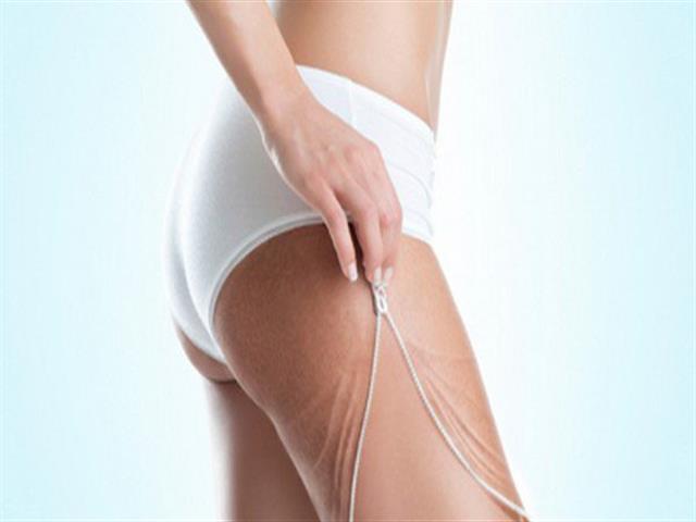 TRATAMENTO DE ESTRIAS E CELULITES EM FLORIANOPOLIS - PRIMORDIALE SC