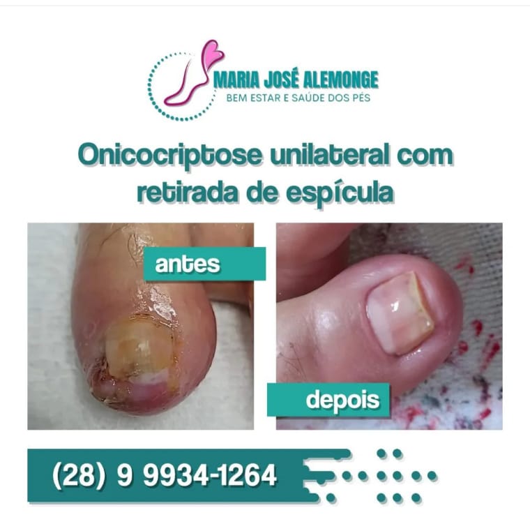 PODÓLOGA EM CACHOEIRO DE ITAPEMIRIM - ES 