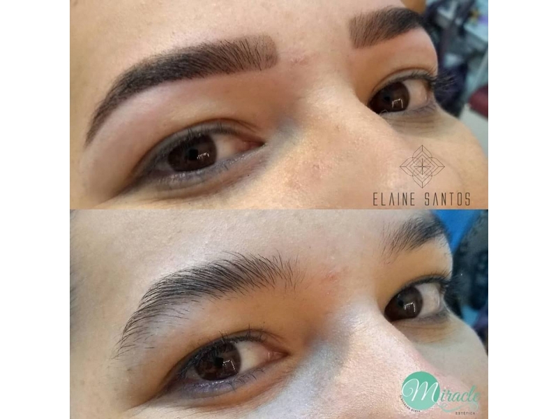 CLÍNICA DE ESTÉTICA EM PETRÓPOLIS - WhatsApp Online - RJ 