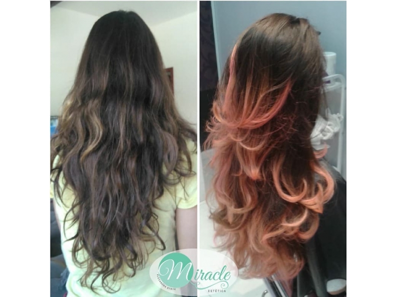 CLÍNICA DE ESTÉTICA EM PETRÓPOLIS - WhatsApp Online - RJ 