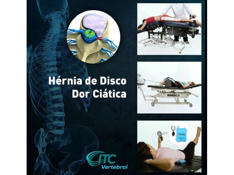 Fisioterapia Especializada em Porto Velho - ITC Vertebral