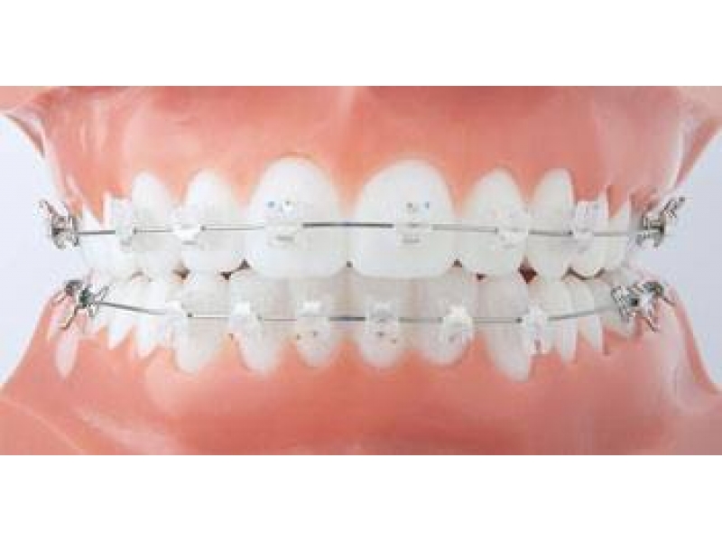CONSULTÓRIO DENTÁRIO EM BONSUCESSO - RJ