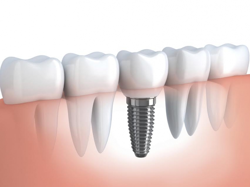 CONSULTÓRIO DENTÁRIO NA PENHA CIRCULAR - RJ