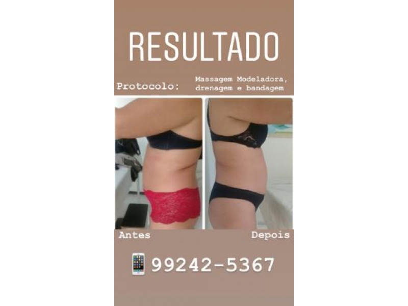 Estética Facial e corporal no Adrianópolis. SPASSO BEAUTY CENTER