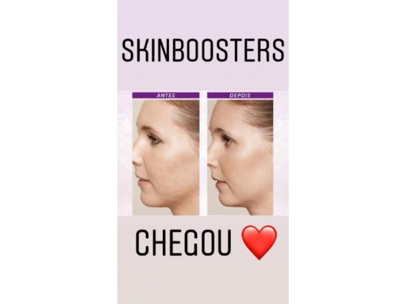 Estética Facial e corporal no Adrianópolis. SPASSO BEAUTY CENTER