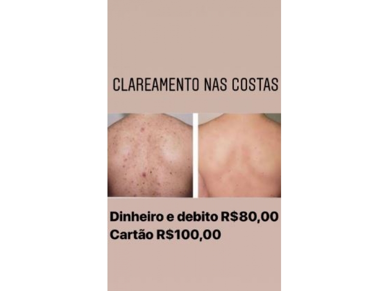 Estética Facial e corporal no Adrianópolis. SPASSO BEAUTY CENTER