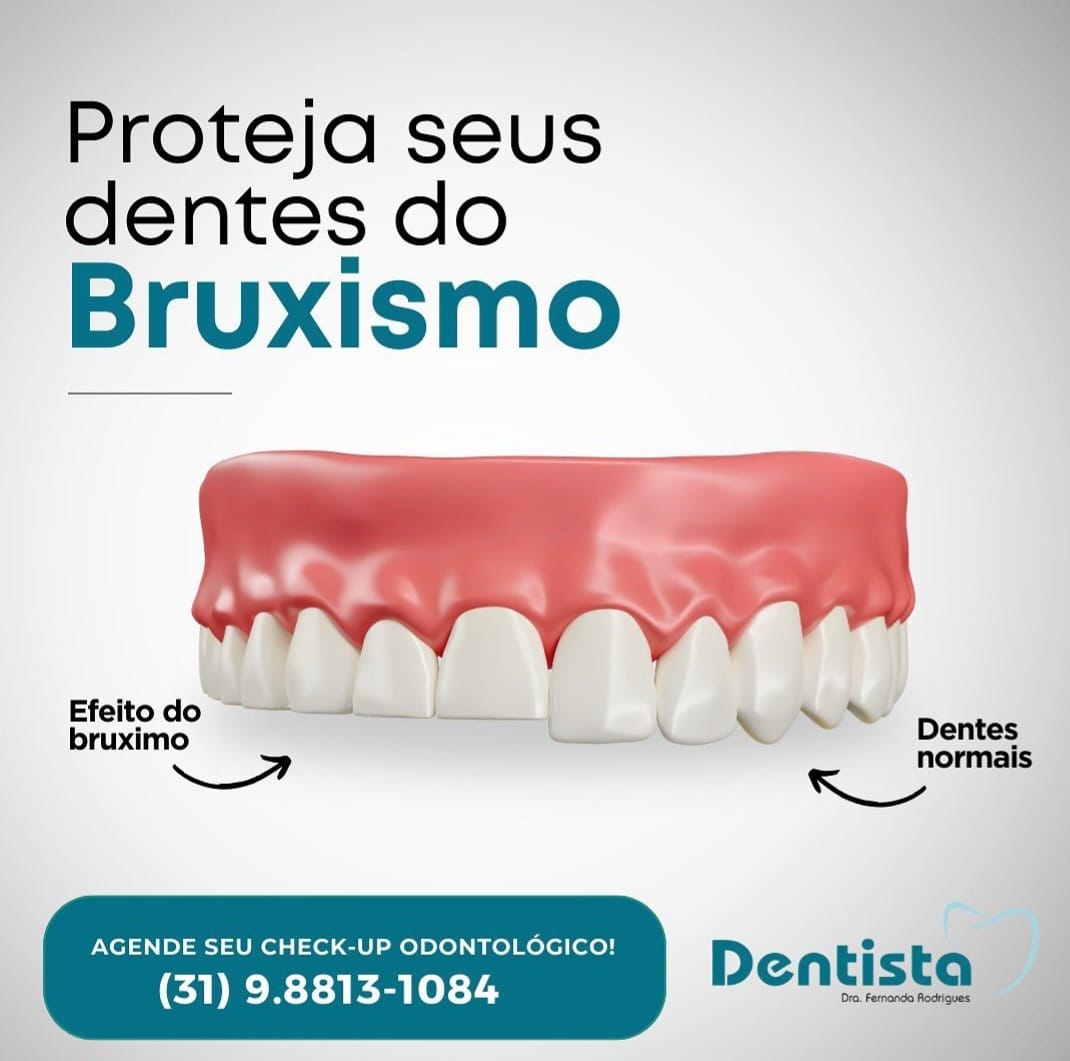INVISALIGN EM CONTAGEM - MG