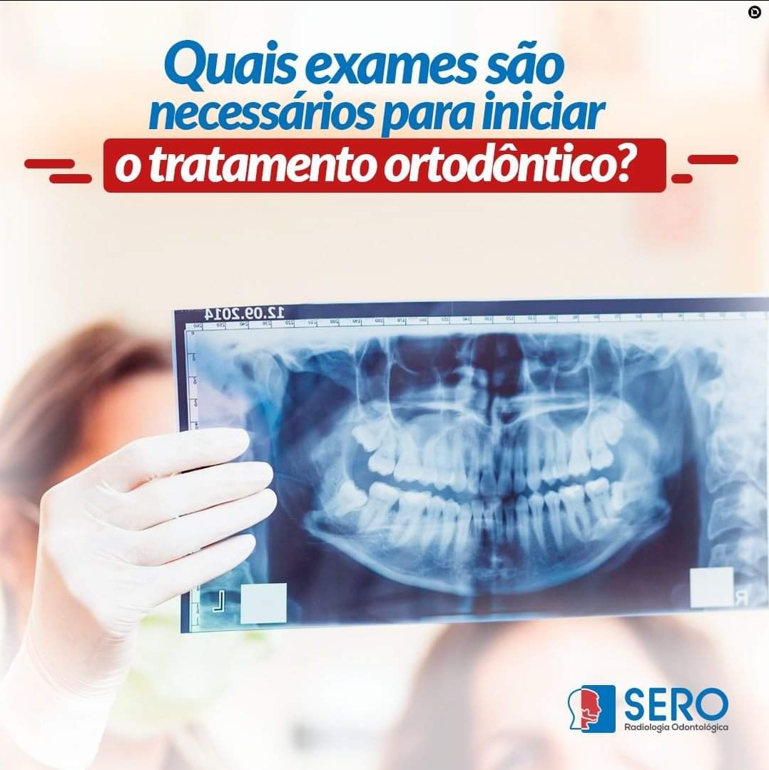 Radiologia Odontológica em Manaus. SERO