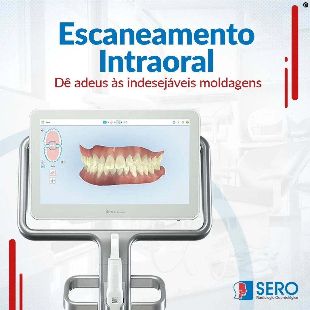 Radiologia Odontológica em Manaus. SERO