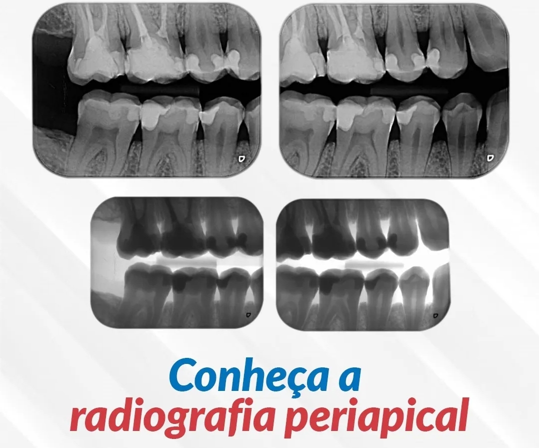 Radiologia Odontológica em Manaus. SERO
