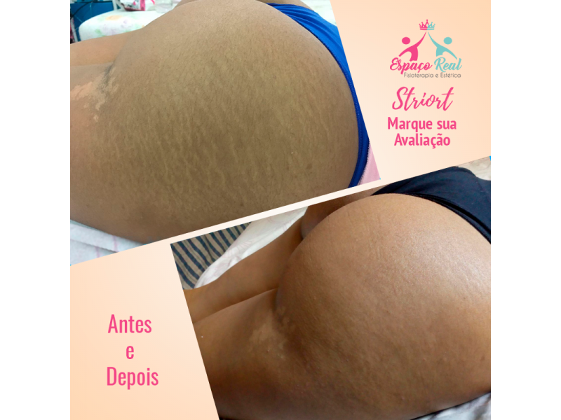 FISIOTERAPIA E ESTÉTICA EM SANTA CRUZ DA SERRA - RJ