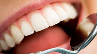 IMPLANTES DENTARIOS EM BELO HORIZONTE ODONTO ÁGAPE MG