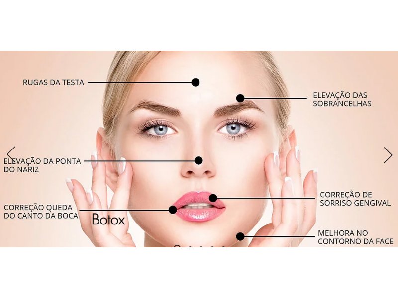 APLICAÇÃO DE BOTOX FACIAL NO RECREIO - BIOPLASTIA OROFACIAL - RJ