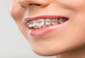 DENTISTA NO BONFIM - SP