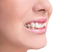 DENTISTA NO BONFIM - SP