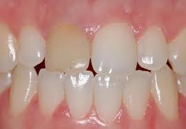 DENTISTA NO BONFIM - SP