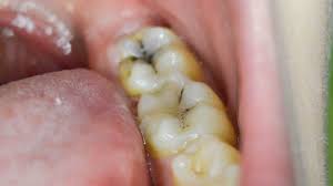 DENTISTA NO BONFIM - SP