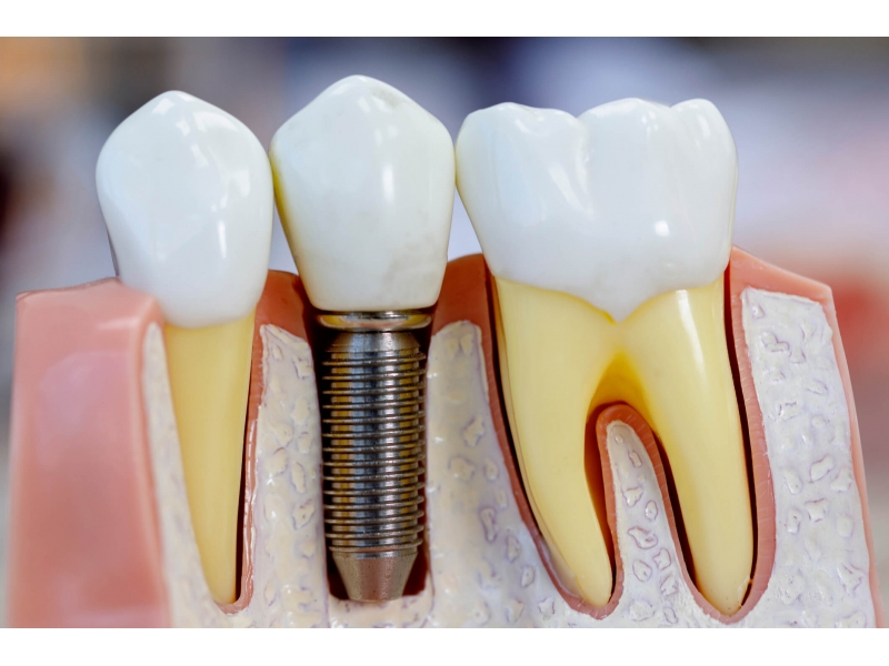 DENTISTA NO BONFIM - SP