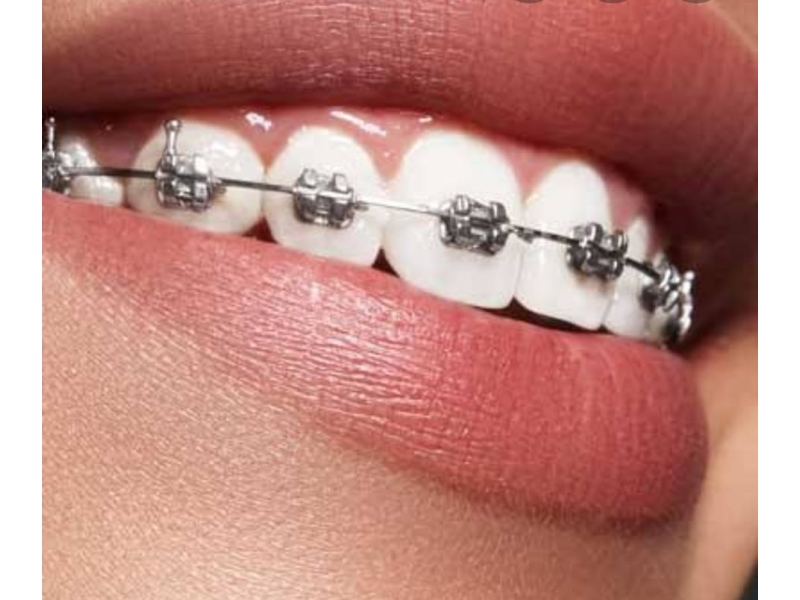 DENTISTA NO BONFIM - SP