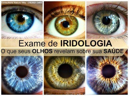 IRIDÓLOGO IRIDOLOGIA EM PARATY RJ