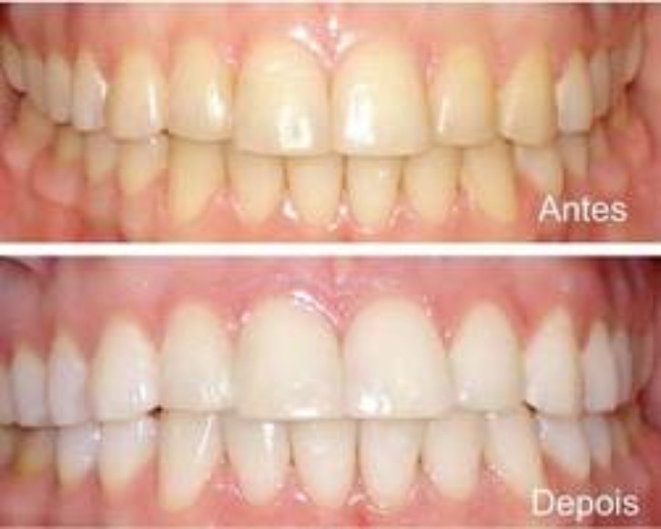 IMPLANTES E REABILITACAO ORAL EM PETROPOLIS