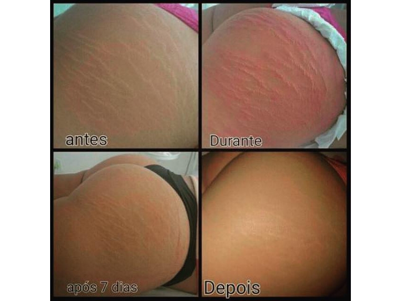 CLINICA DE ESTÉTICA NA BARRA DA TIJUCA 