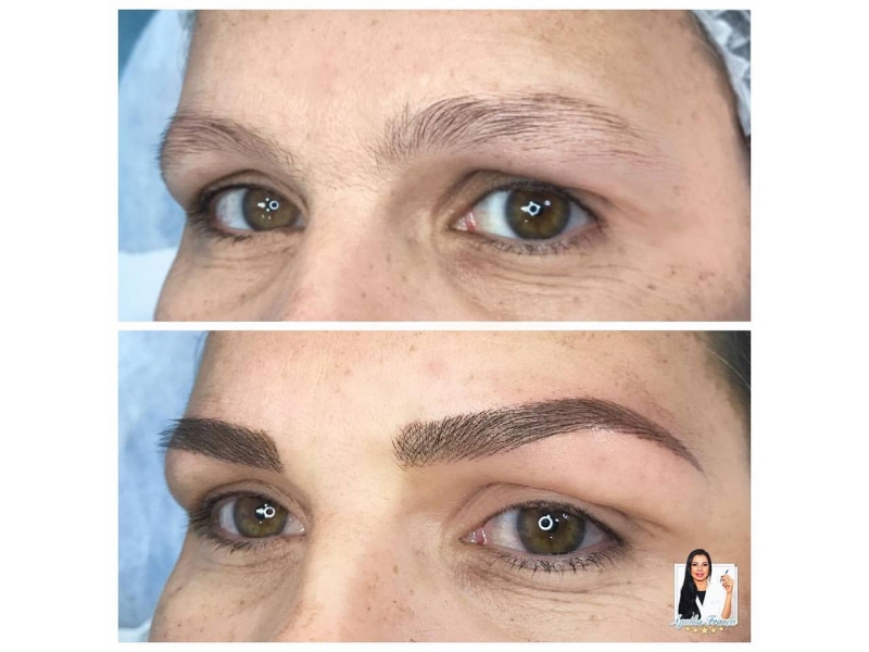 MICROPIGMENTAÇÃO  DE SOBRACELHAS