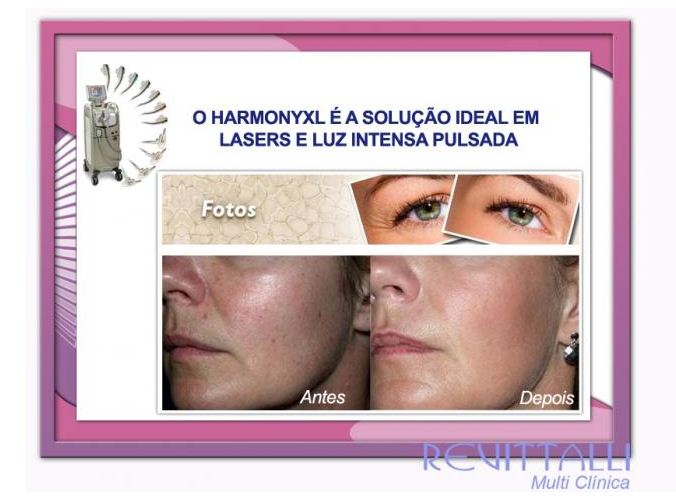 CLINICA DE ESTÉTICA EM LONDRINA - REVITTALLI - RS