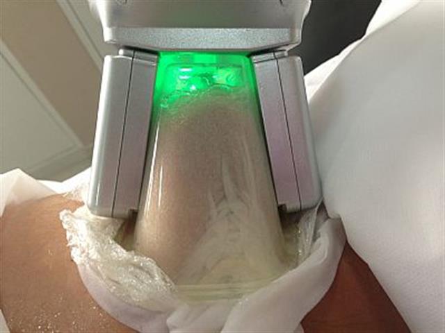 TRATAMENTO PARA ESTRIAS E CELULITES EM SALVADOR - ESTETICA BA