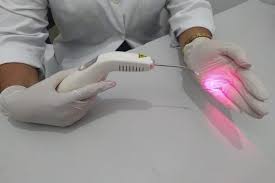 TRATAMENTO DE DOR A LASER EM SÃO JOSÉ DOS CAMPOS - SP