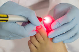 TRATAMENTO DE DOR A LASER EM SÃO JOSÉ DOS CAMPOS - SP
