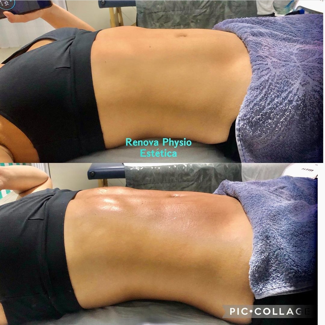 ESTÉTICA CORPORAL E FACIAL NO COROADO EM MANAUS - AM