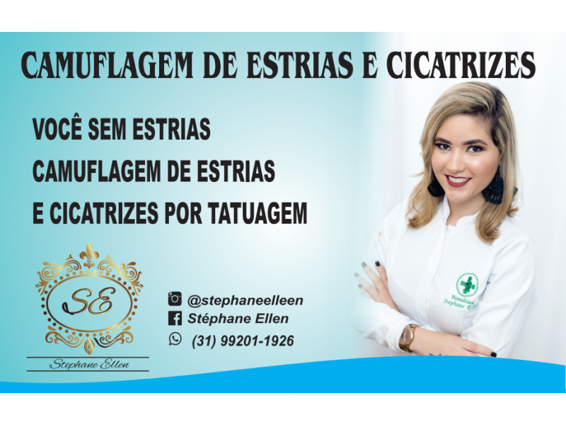 CAMUFLAGEM DE ESTRIAS EM BELO HORIZONTE